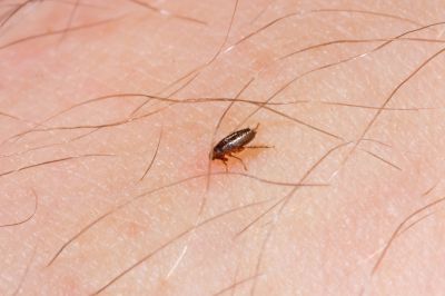 Flea Treatment For Home - Flea Control Italy, Texas